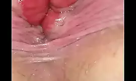 Gapping my Ass Hole near patch up and personal